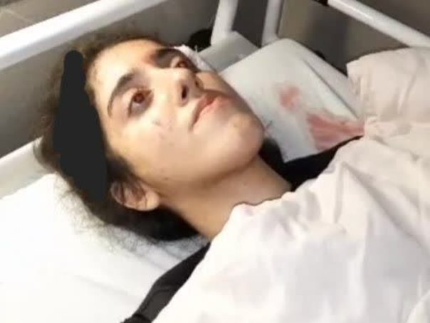 پلیس با تکذیب کشته شدن دختر ۲۰ ساله در پیاده راه فرهنگی رشت: او از ناحیه سر دچار آسیب شده / پس از معاینات پزشکی مشخص شد موضوع صدمه وارده به او چندان جدی نبوده