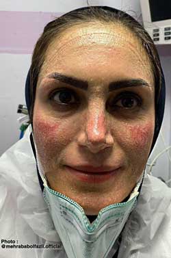 مهاجرت سه هزار پزشک ایرانی در دوران کرونا