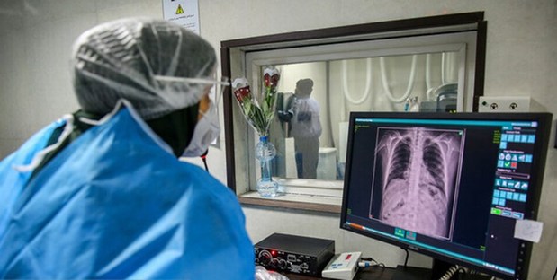 آمار میتلایان به کرونا در 24ساعت گذشته آمار میتلایان به کرونا در 24ساعت گذشته