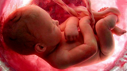 جزئیات طرح جدید مجلس برای سقط جنین