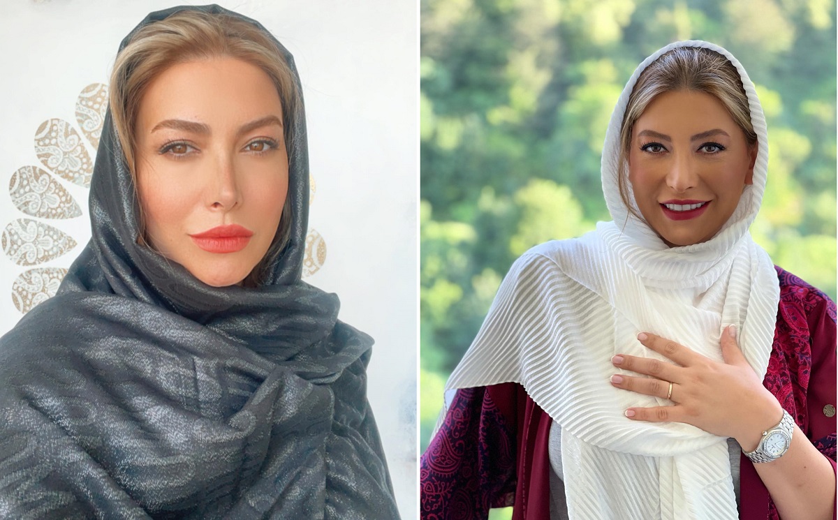 عکس تغییر وحشتناک چهره فریبا نادری