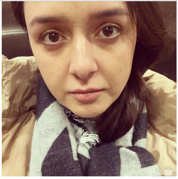 شوخی ترانه علیدوستی با چاقی دماغ/عکس