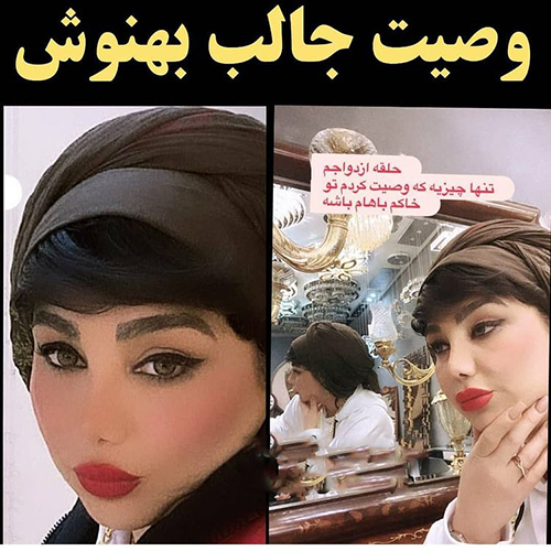 این خانم بازیگر رکورددار جراحی زیبایی ایرانی + عکس