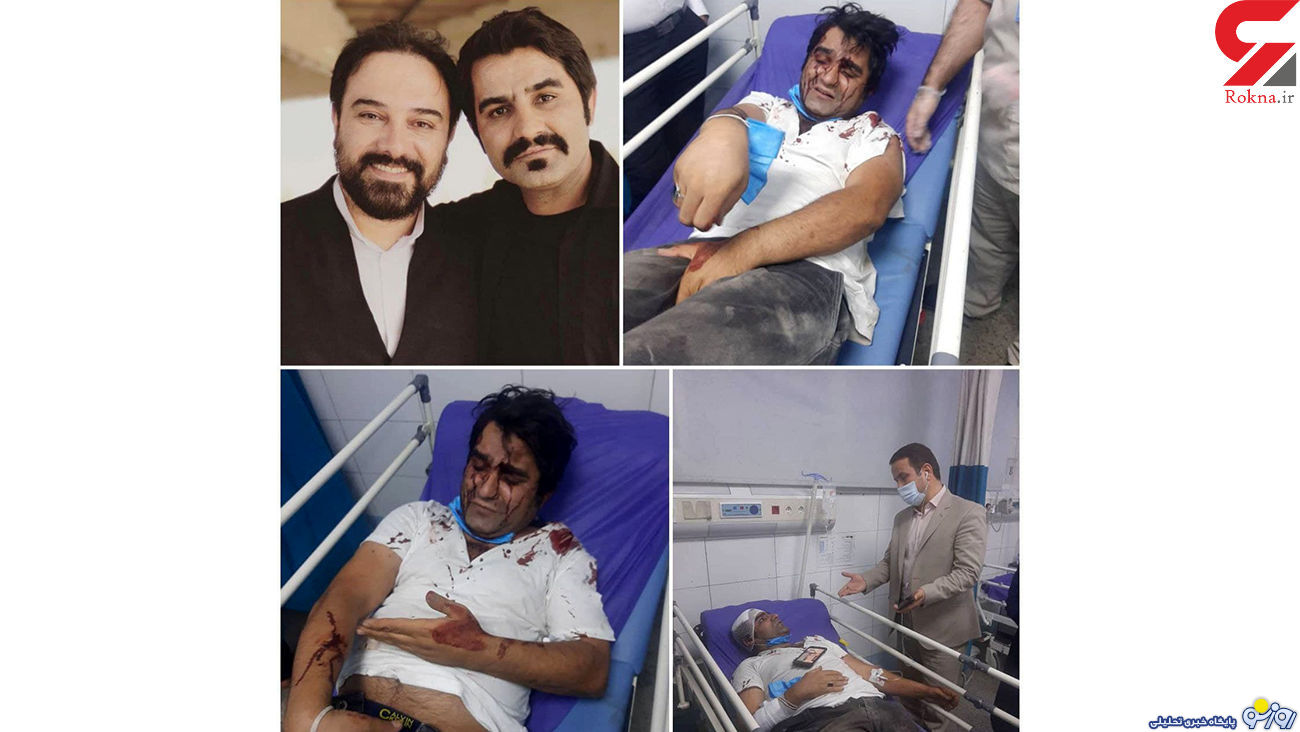 حمله خونین به 2 بازیگر سریال دودکش + عکس
