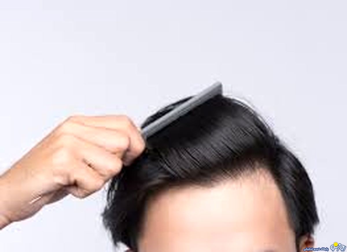 بیوتین به رشد مو کمک می‌کند؟