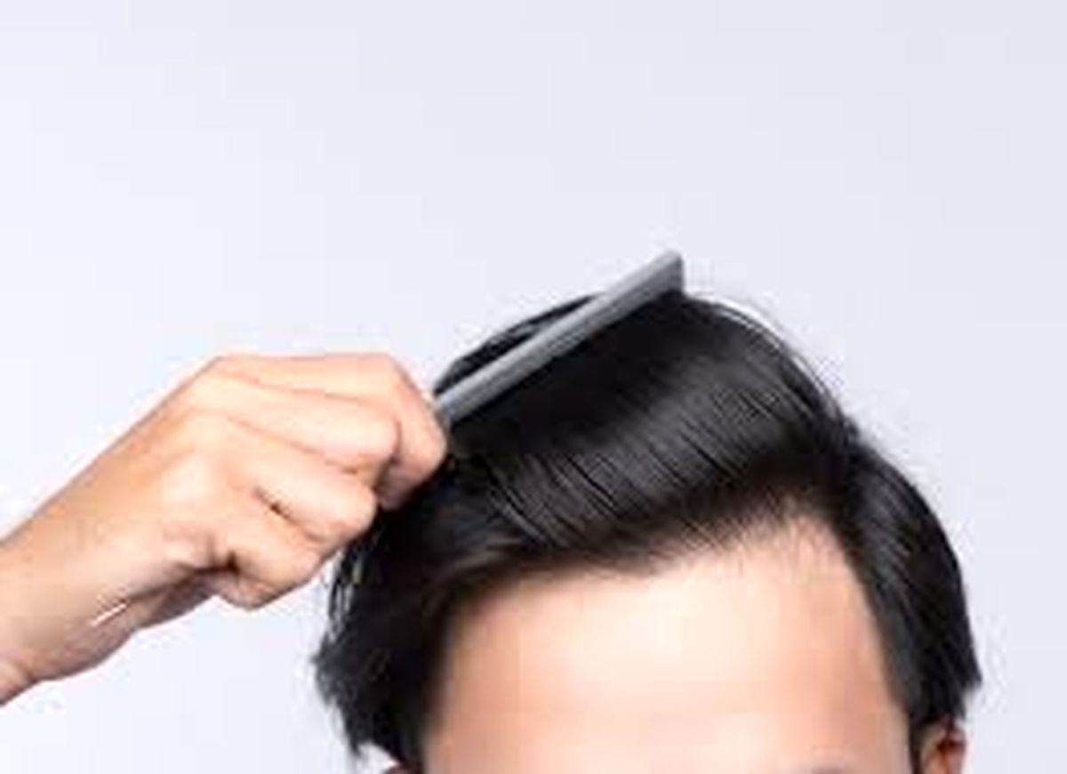 آمپول بيوتين و بپانتن برای تقویت مو مفید است ؟
