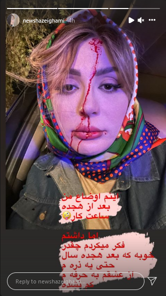 زخمی شدن نیوشا ضیغمی در تصادف/عکس زخمی شدن نیوشا ضیغمی در تصادف/عکس