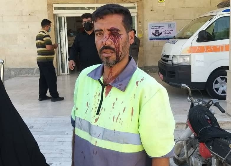 ماجرای ضرب و شتم کارگر شهرداری خرمشهر ماجرای ضرب و شتم کارگر شهرداری خرمشهر