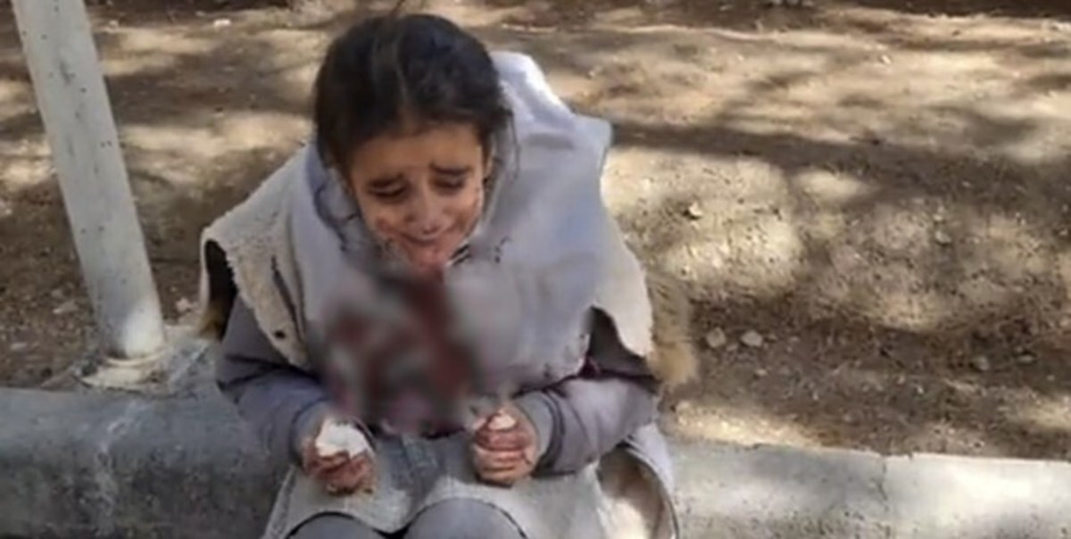 ماجرای دختر دانش‌آموز اصفهانی با صورت خون‌آلود چه بود؟/ ضرب و شتم دختر ۹ ساله بخاطر حجاب؟