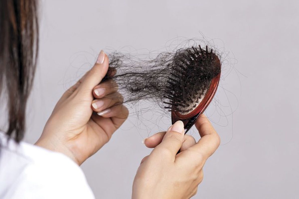 آیا ریزش مو در یائسگی طبیعی است؟