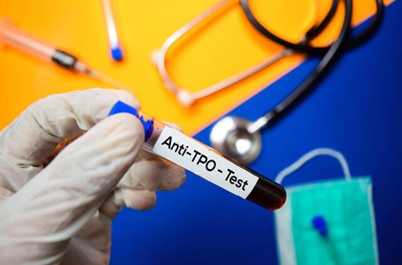 انجام آزمایش Anti TPO برای چه کسانی ضرورت دارد؟