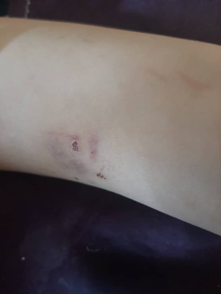 اذیت و آزار یک معلول جسمی ذهنی در مرکز نگهداری معلولان بنت الرسول اذیت و آزار یک معلول جسمی ذهنی در مرکز نگهداری معلولان بنت الرسول