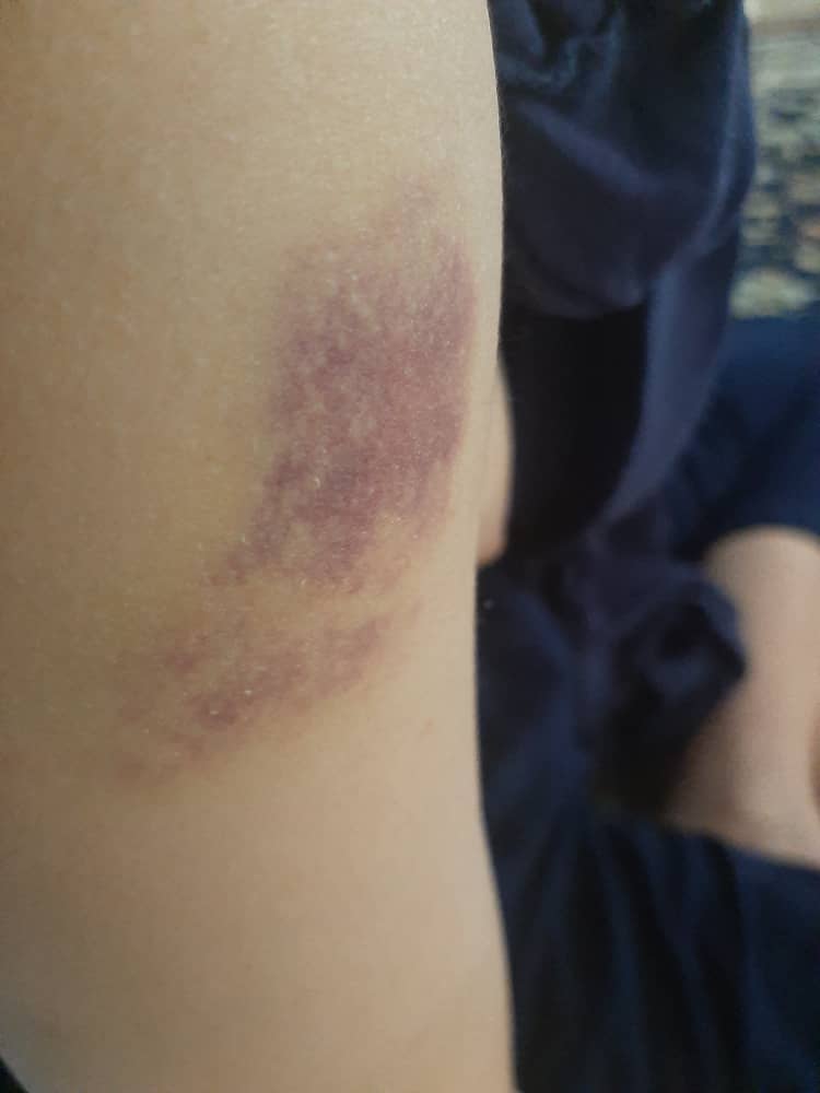 اذیت و آزار یک معلول جسمی ذهنی در مرکز نگهداری معلولان بنت الرسول اذیت و آزار یک معلول جسمی ذهنی در مرکز نگهداری معلولان بنت الرسول