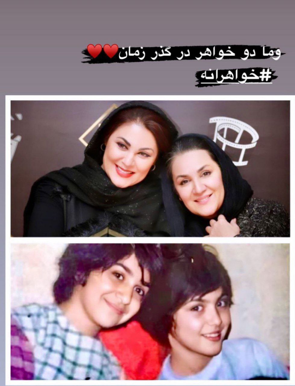 تغییرات باورنکردنی لاله و ستاره اسکندی از کودکی تا امروز/عکس