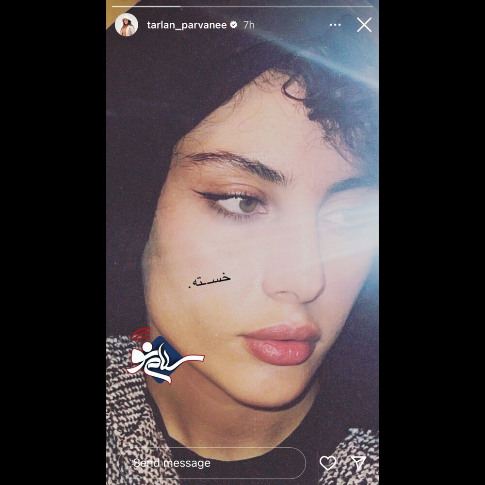 عکس جدید ترلان پروانه با چهرهای خسته عکس جدید ترلان پروانه با چهرهای خسته