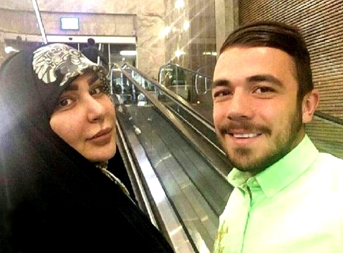 عکس قبل و بعد عمل زیبایی زن جوان قلعه نویی عکس قبل و بعد عمل زیبایی زن جوان قلعه نویی