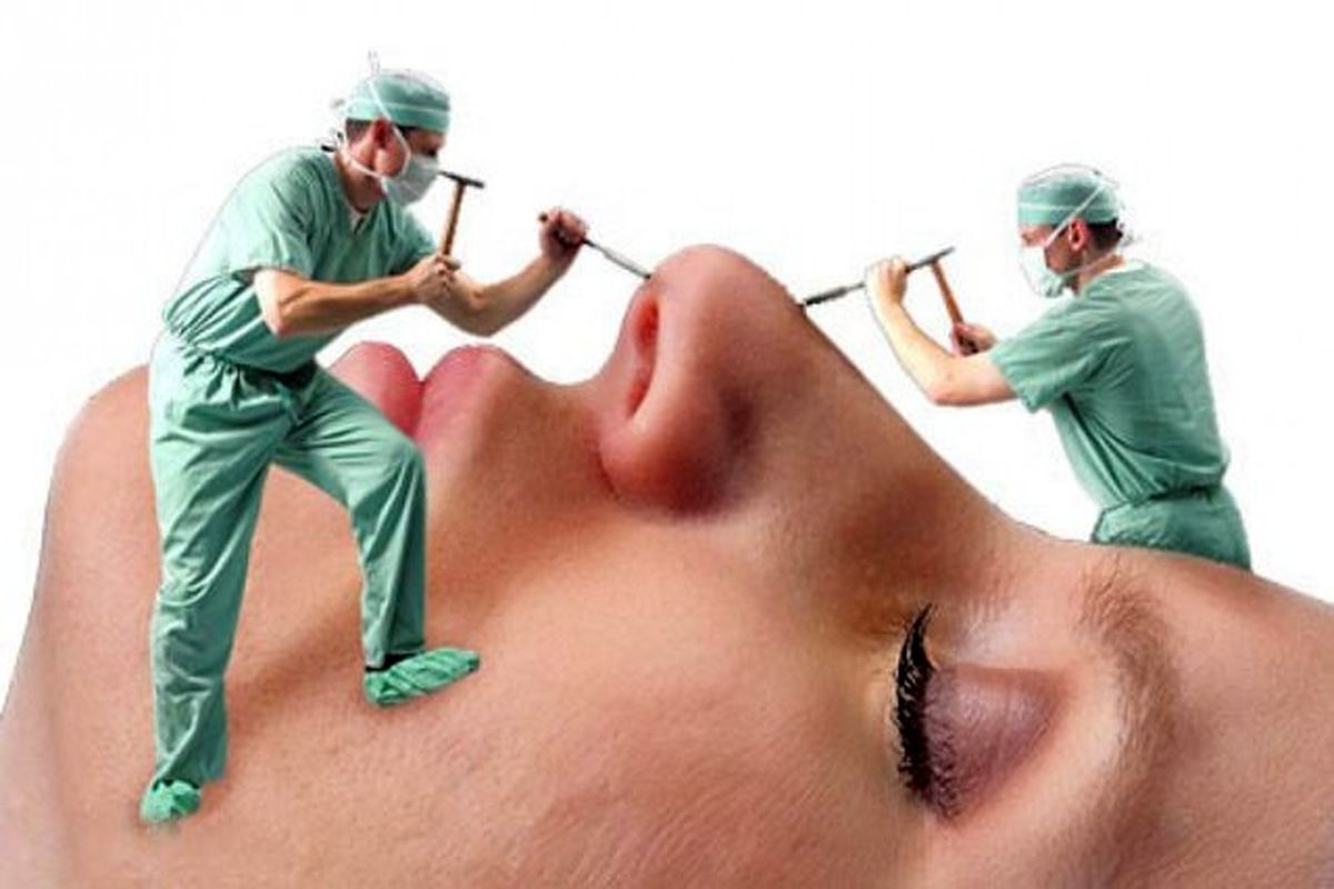 سن مناسب برای عمل زیبایی بینی چقدر است؟ سن مناسب برای عمل زیبایی بینی چقدر است؟