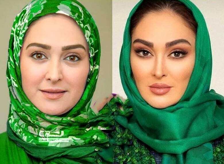 تغییر عجیب فیس الهام حمیدی با عمل زیبایی+ عکس تغییر عجیب فیس الهام حمیدی با عمل زیبایی+ عکس