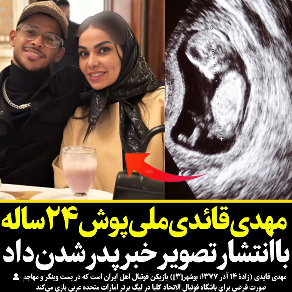 سونوگرافی ستاره معصومی کولاک کرد/مهدی قایدی پدر شد+ عکس سونوگرافی ستاره معصومی کولاک کرد/مهدی قایدی پدر شد+ عکس