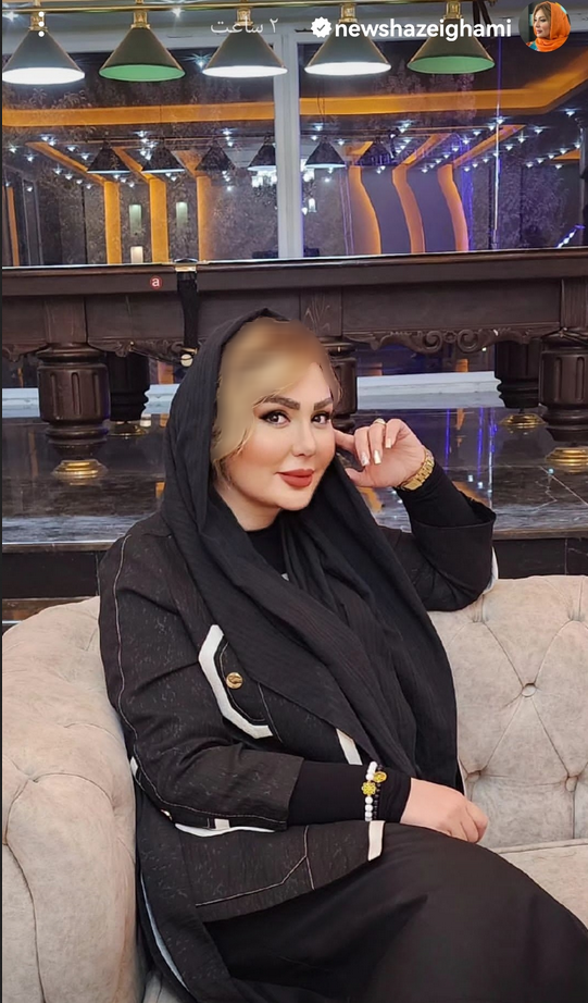 چهره مصنوعی نیوشا ضیغمی بعد از طلاق /عکس