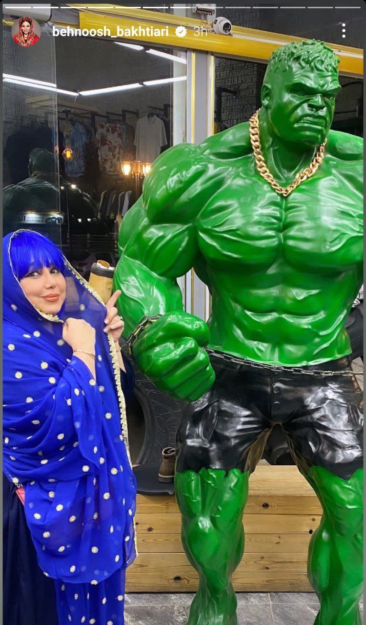 رنگ عجیب موهای خانم بازیگر در این عکس