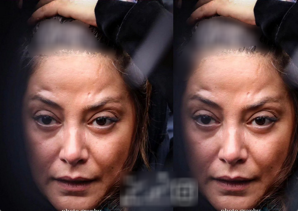 چرا طناز طباطبایی یک شبه پیر شد / عکس