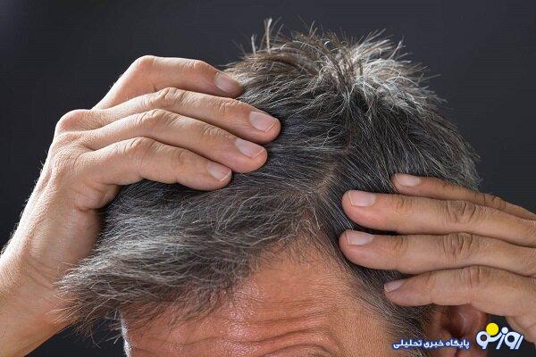 دلیل خشکی مو چیست؟