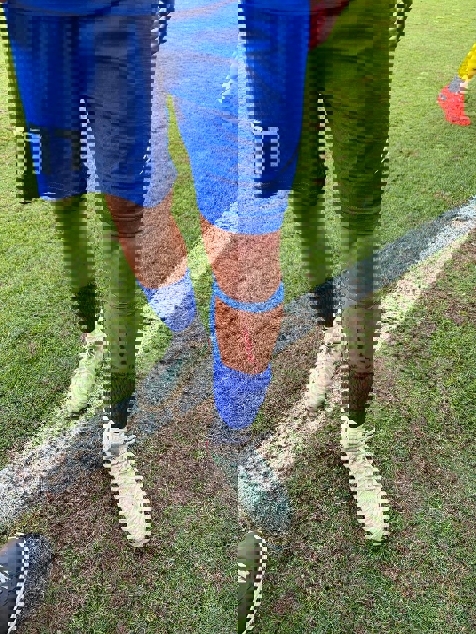 عکس | بلایی که سر این ستاره استقلال توسط یک پرسپولیسی آمد