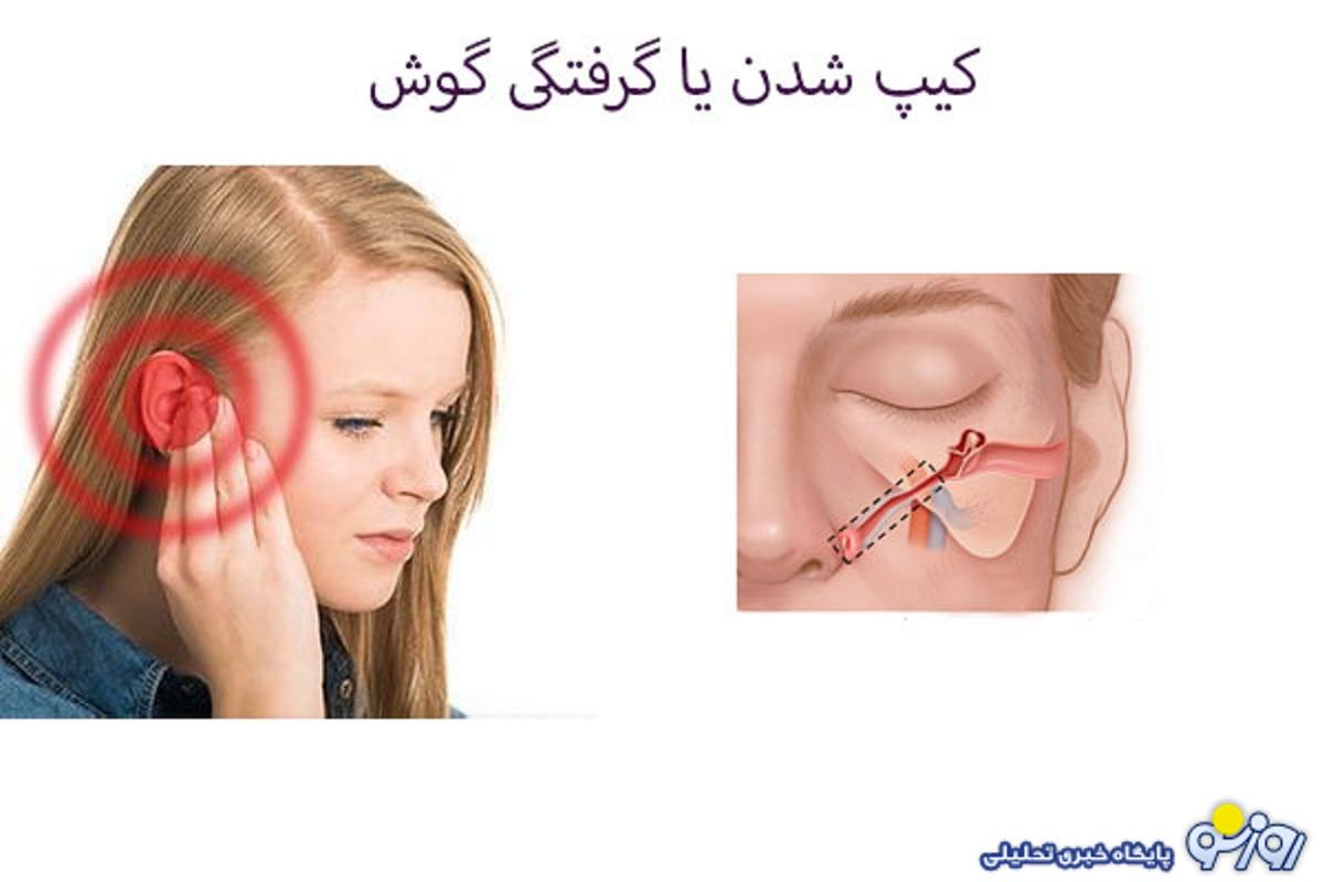 برای گرفتگی گوش چیکار کنیم؟ برای گرفتگی گوش چیکار کنیم؟