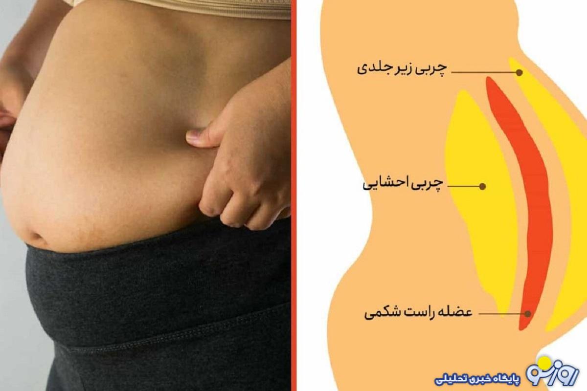 چربی شکم چیست و راه‌های درمان آن کدامند؟