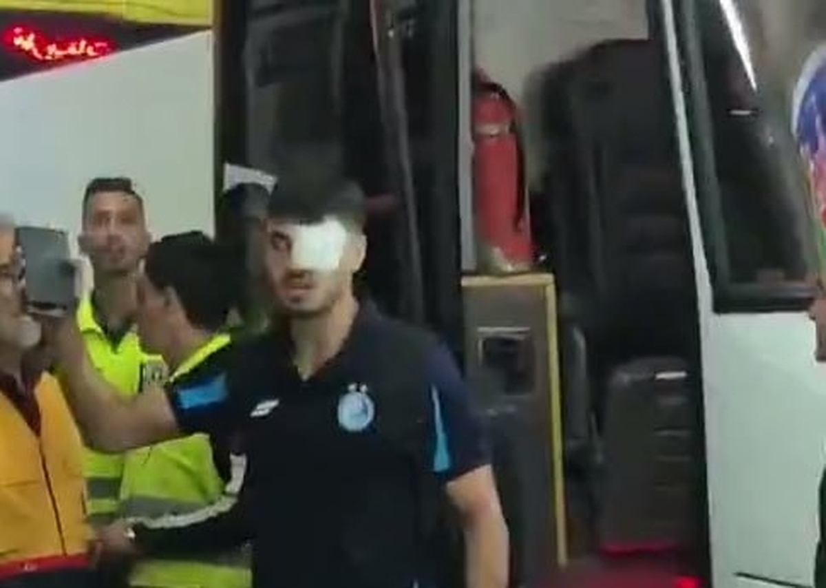 مهاجم استقلال : چشمم نمی‌بیند(+عکس)