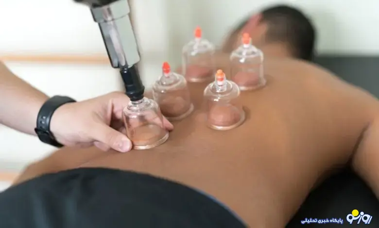 بهترین روزها برای حجامت در پاییز بهترین روزها برای حجامت در پاییز