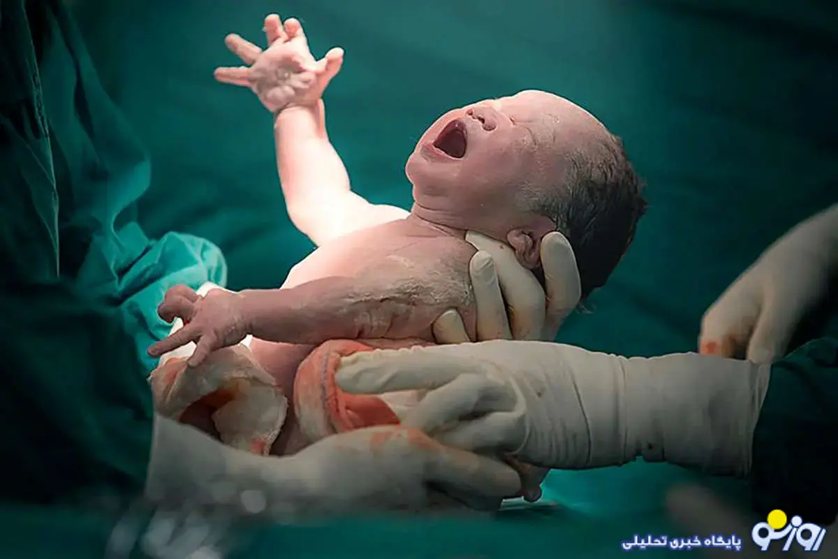 دلایل استقبال بانوان ایرانی از سزارین!