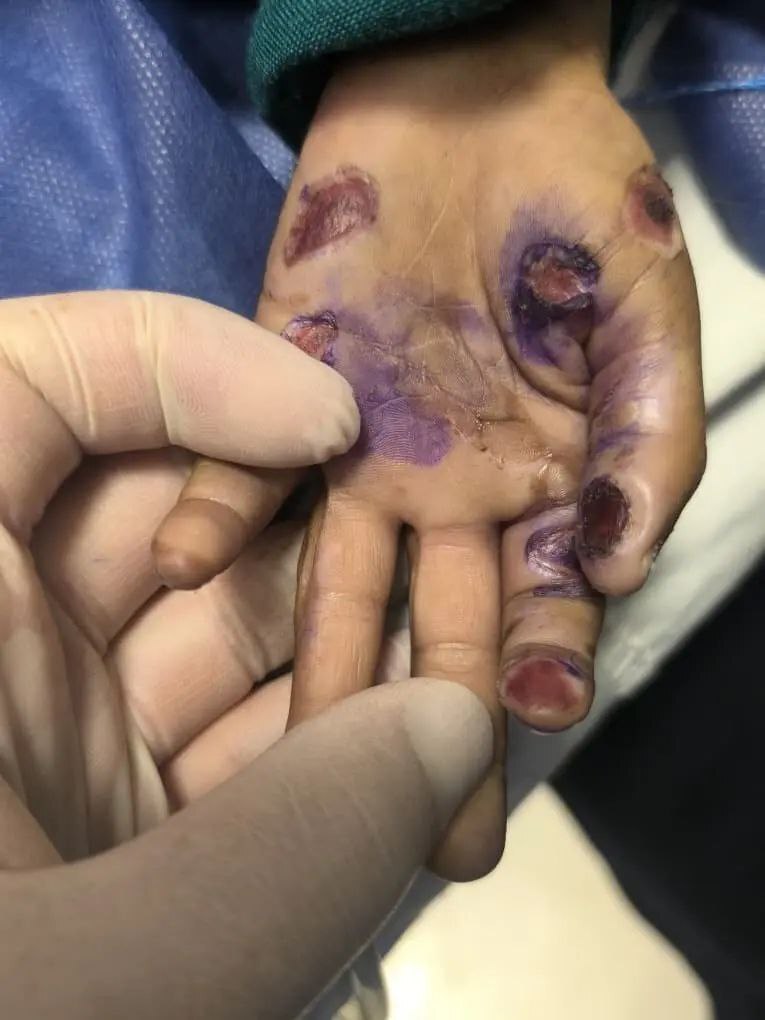 فوت یک کودک ۴ساله