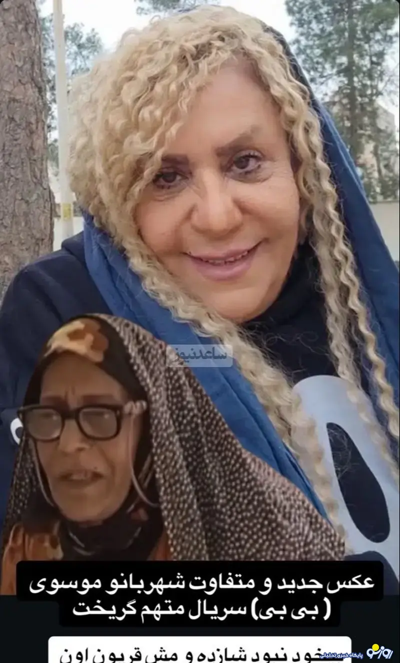 تغییر چهره عجیب بازیگر خانم ایرانی!