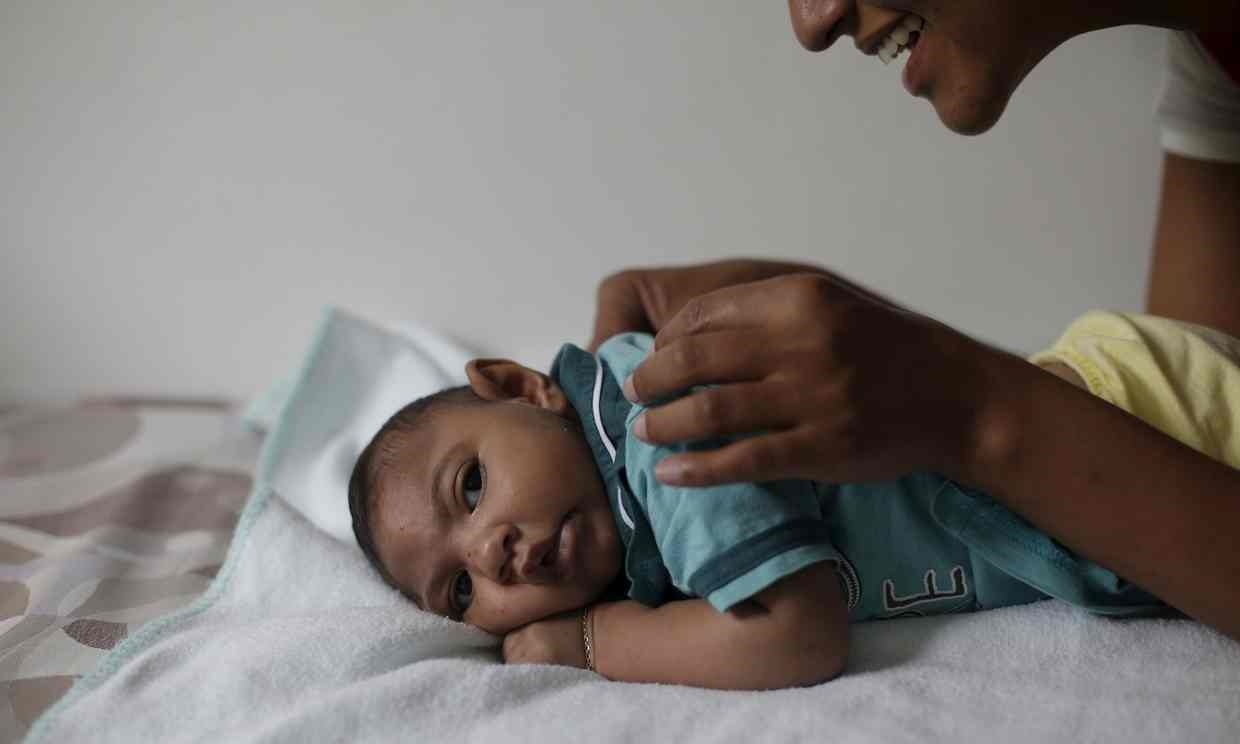 وضعیت طول عمر کودکان میکروسفالی