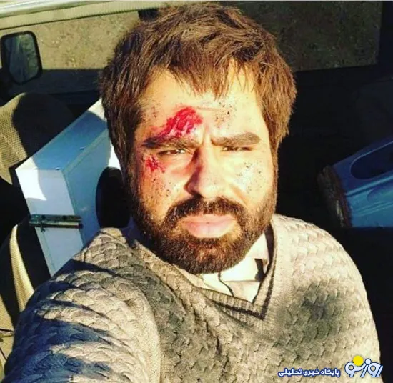 امیر نوری در جنگ با داعش مجروح شد+ عکس