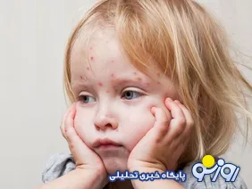 سرخک با شدت بازگشت!