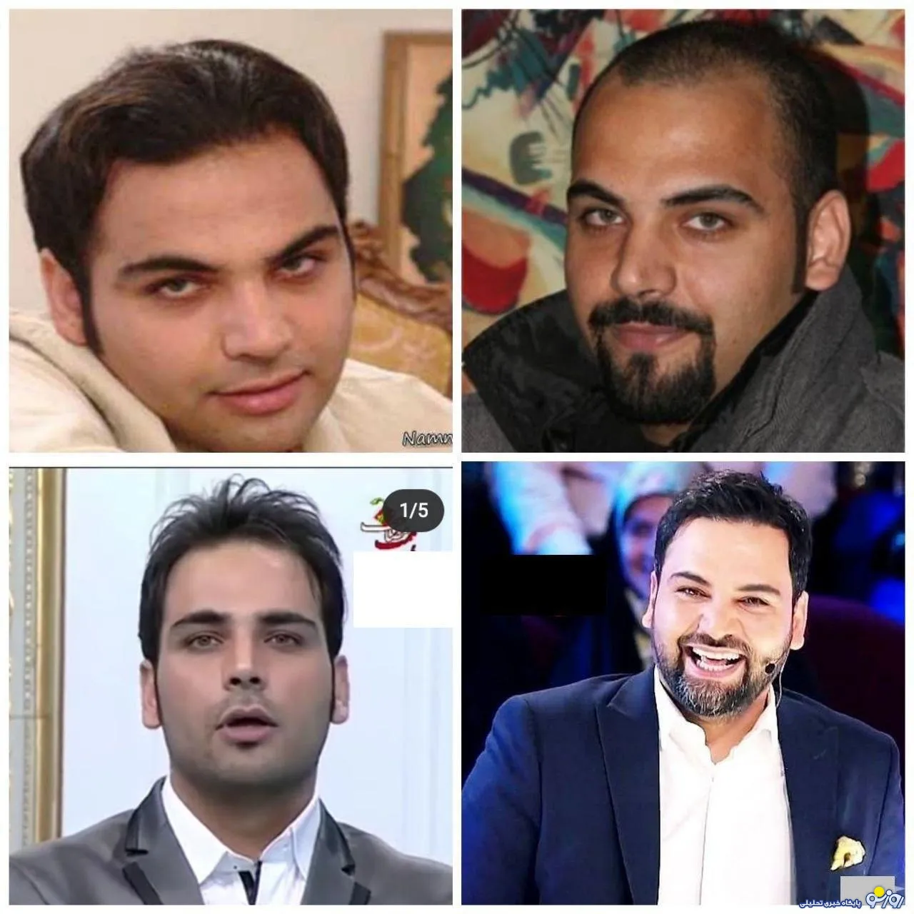 تغییر چهره عجیب احسان علیخانی طی چند سال +عکس