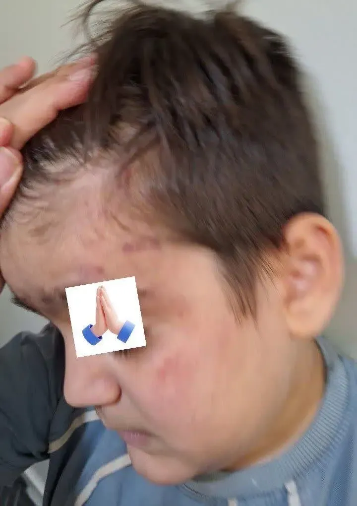6459380